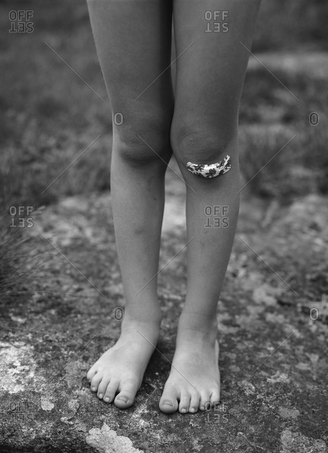 A child with a plaster on the knee, Sweden