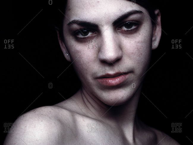 Portrait Of Androgynous Person With Acne