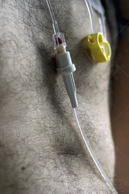 An intravenous drip across a man\'s chest