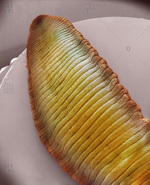 Magnification of a Leech under a Color scanning electron micrograph.