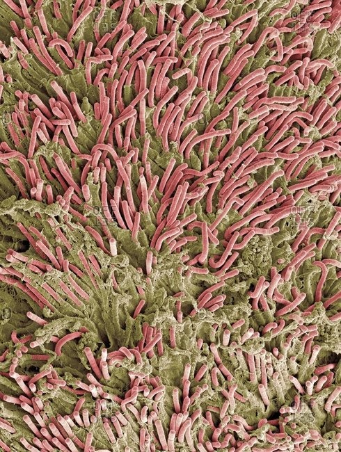 Dental plaque under Color scanning electron micrograph