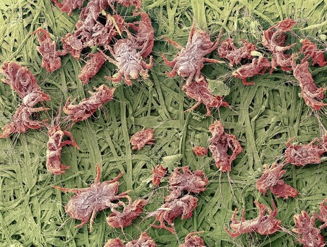 Color scanning electron micrograph of a number of house dust mites (Dermatophagoides pteronyssinus)