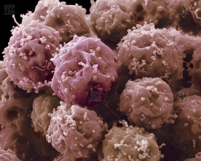 Embryonic stem cells (ESCs), Color scanning electron micrograph.