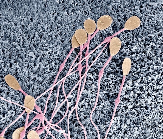 Dog sperm under a Color scanning electron micrograph.