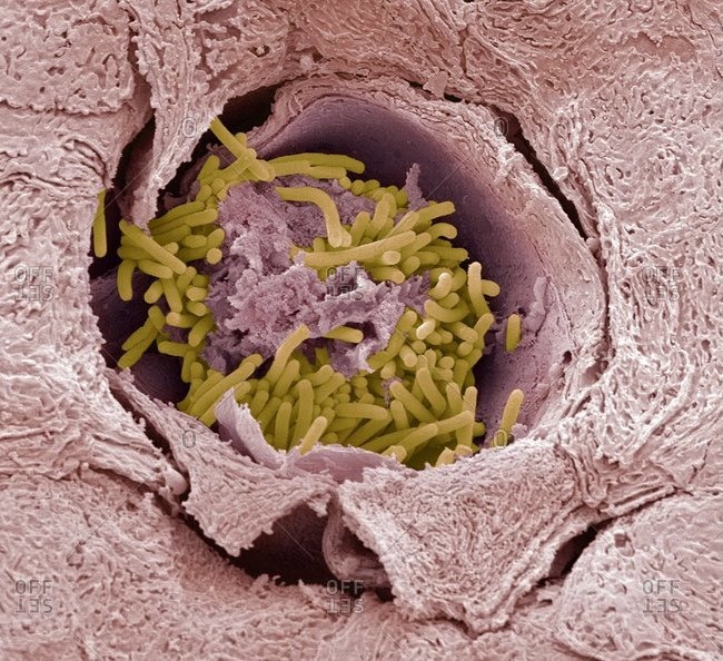 Color scanning electron micrograph of rod shaped bacteria (yellow) on the tongue of a Kudu antelope (Tragelaphus sp.).