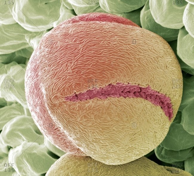 Strawberry (Fragaria vesca) pollen grain under a Color scanning electron micrograph.