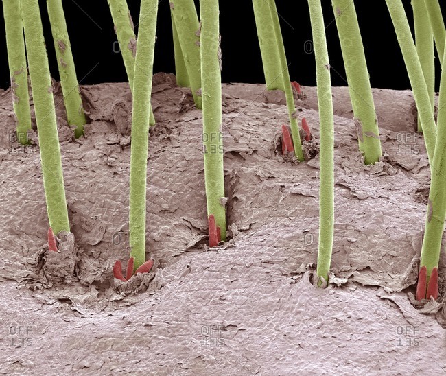 Eyelash mites under a Color scanning electron micrograph.