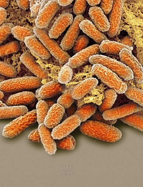 Escherichia coli bacteria under a Color scanning electron micrograph.