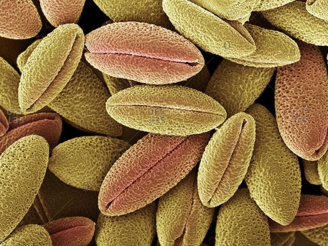 Magnification view of Clematis montana pollen grains under a Color scanning electron micrograph