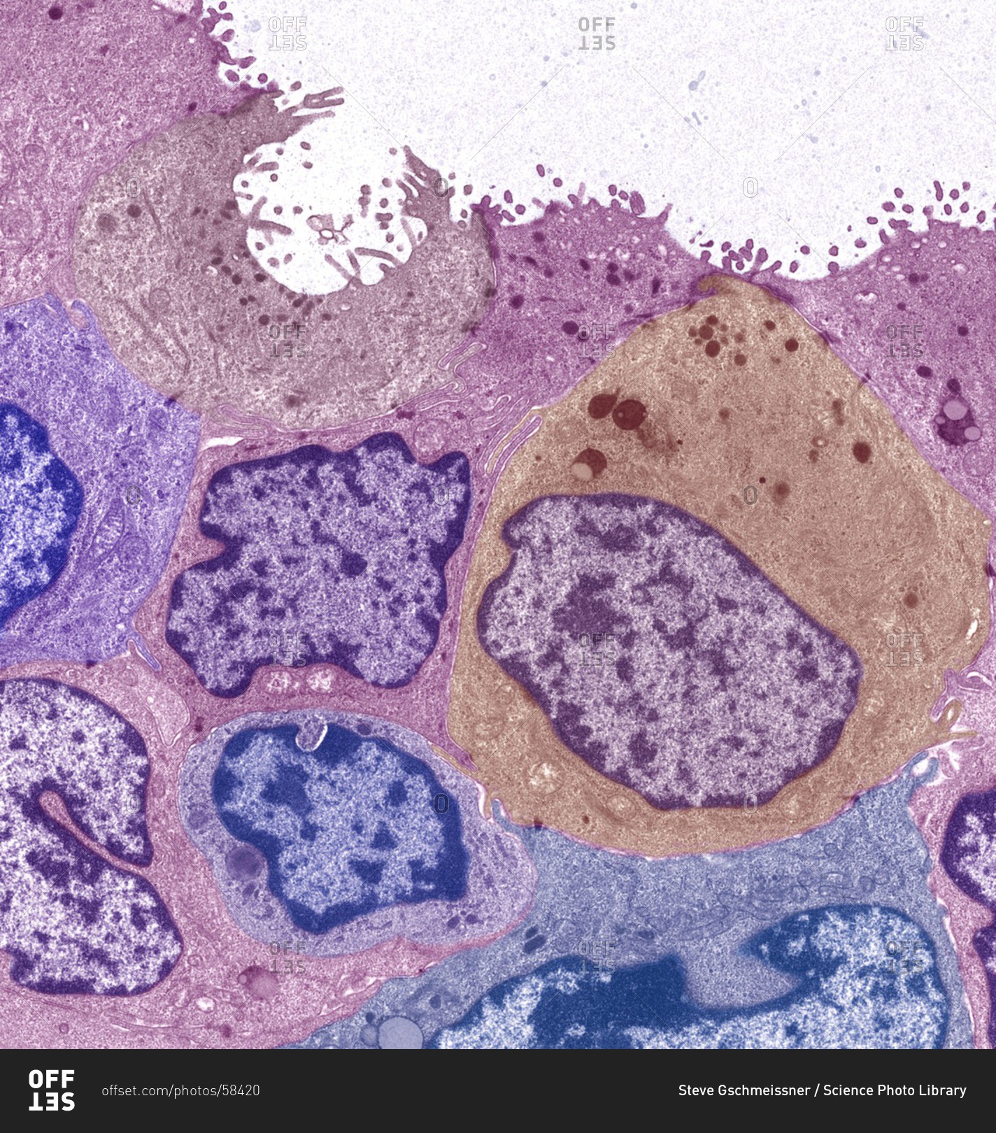 Color Transmission Electron Micrograph Tem Of A Section Through A