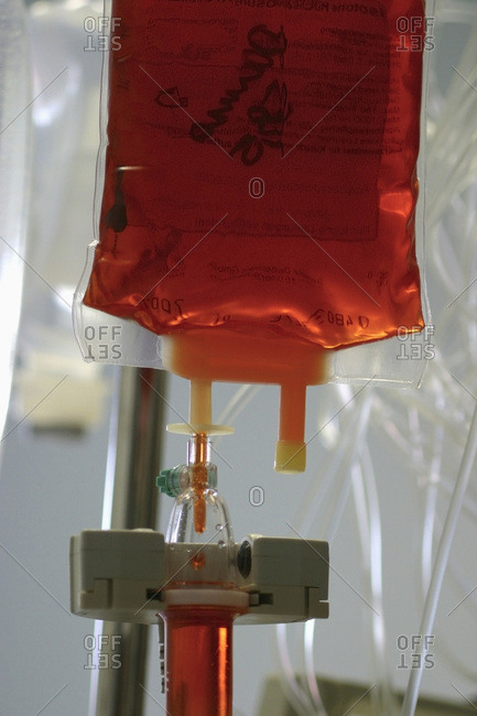 An intravenous drip filled with red fluid
