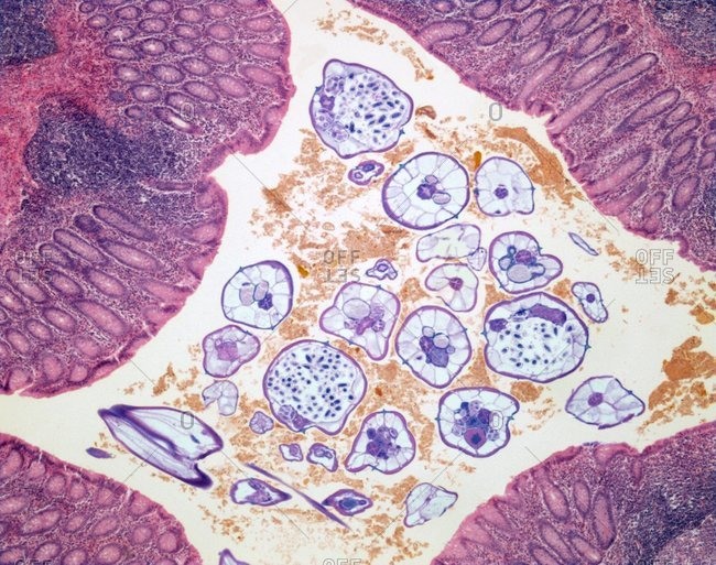 Nematode infection. Light micrograph of a section through a stomach infected with parasitic nematode worms (purple). Food debris (orange) is also seen. Magnification: x60 when printed at 10 centimeters wide.