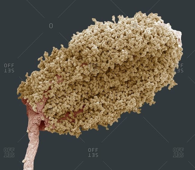 Color scanning electron micrograph of a wood anemone (Anemone nemerosa) anther (male reproductive part) covered in pollen.