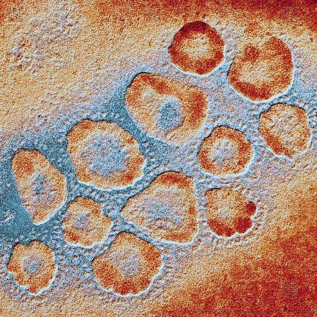 Microscopic view of coronaviruses