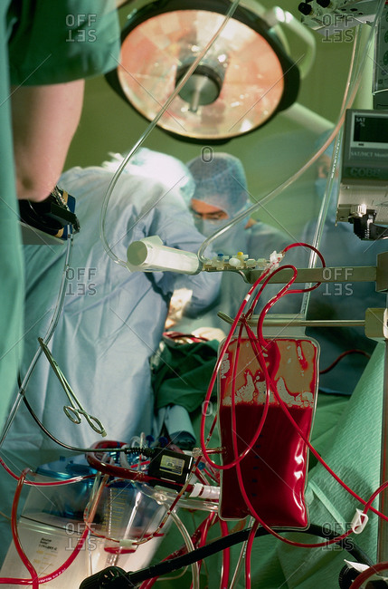 View of a Cardiopulmonary bypass, temporarily takes over the function of the heart and lungs during surgery