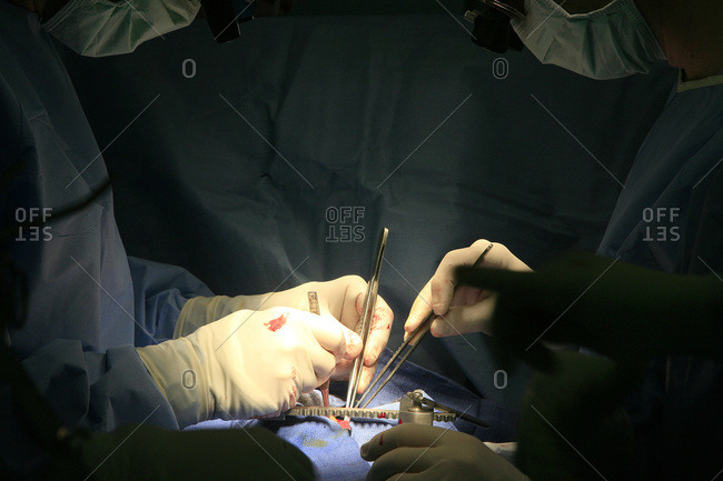 Surgeons performing heart prosthesis surgery.