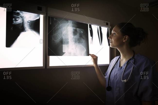 Female radiologist examining x-rays