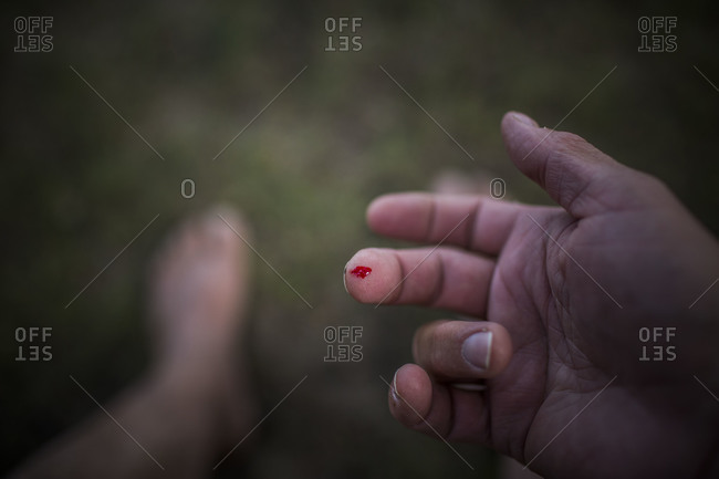 Close up of the bleeding thumb of a man