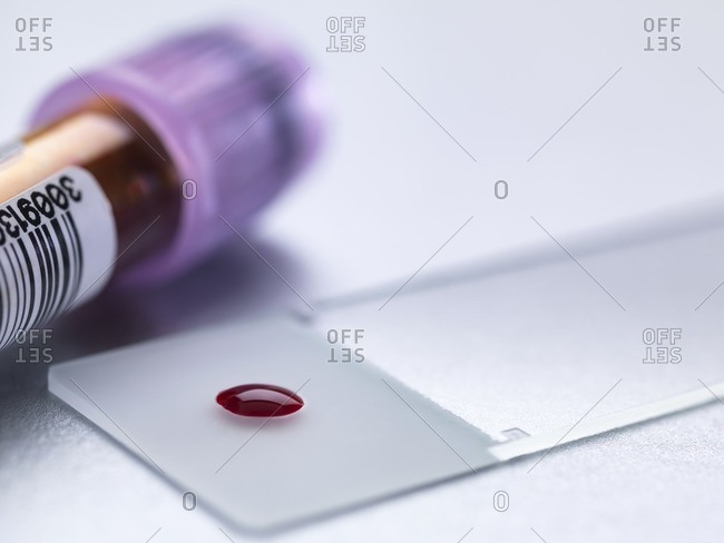 Sample of blood on a microscope slide next to a blood tube
