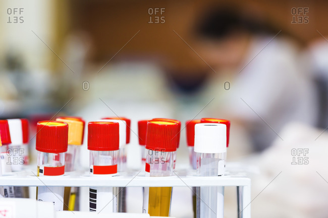 Blood samples in test tube rack