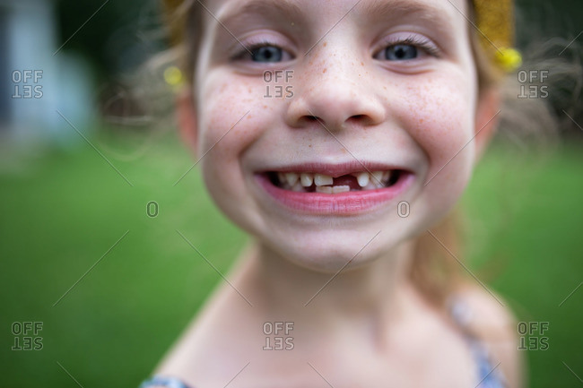 Girl with toothless smile