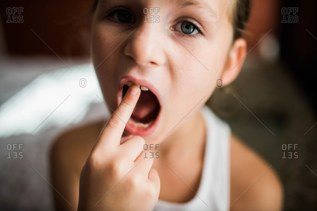 A girl points to her loose tooth