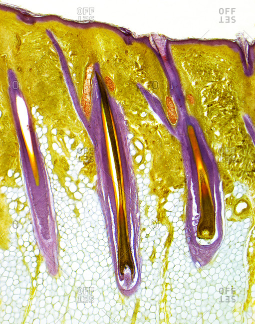 Light micrograph of a thick section of human skin, showing three central hair follicles