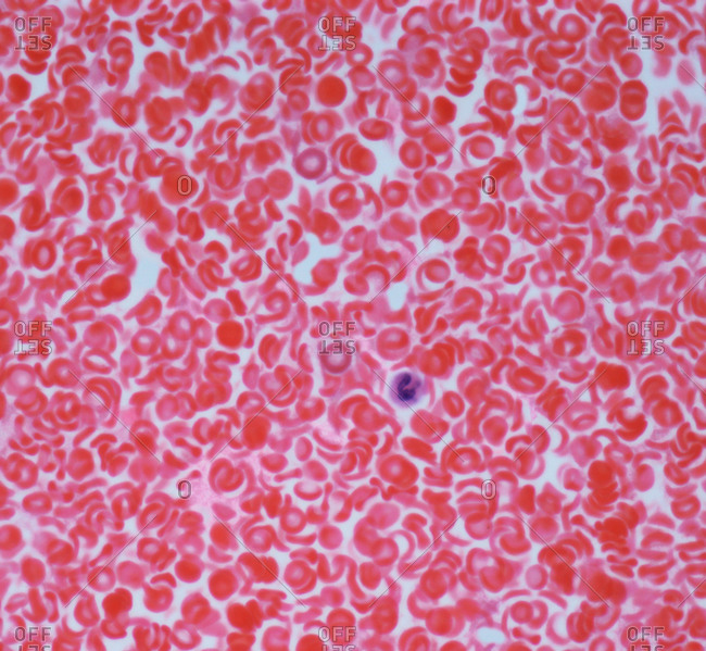 Light micrograph of red blood cells (erythrocytes, red) in a blood vessel