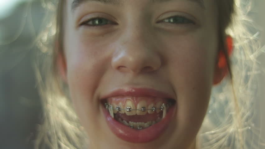 Tiny teen braces extreme bizarre compilation