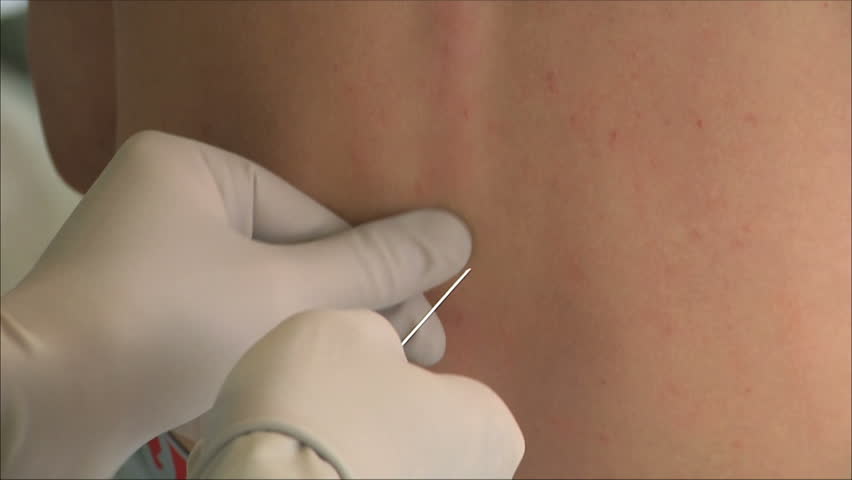 injection in the back with a closeup