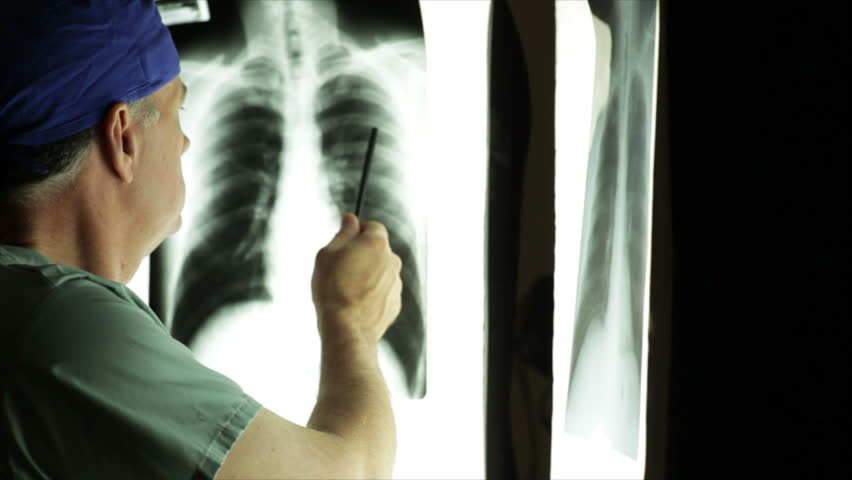 A mature male doctor looking at an x-ray displayed on an illuminated panel in a dark room.