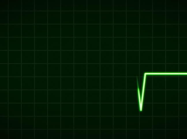 ECG Cardio vascular heart monitor showing heartbeat pulse. NTSC.