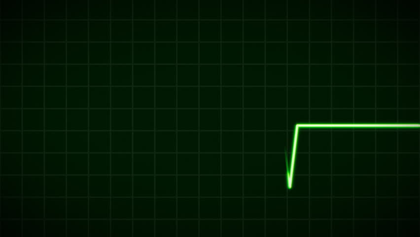 ECG Cardiovascular heart monitor showing heartbeat pulse. HD 1080.