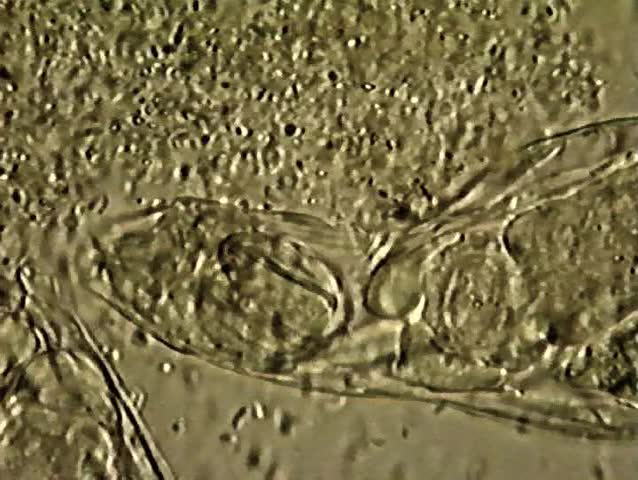 Educational Microscopic: Two Rotifers feed on motile spirillum bacteria.