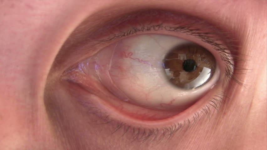 Disturbing Eye