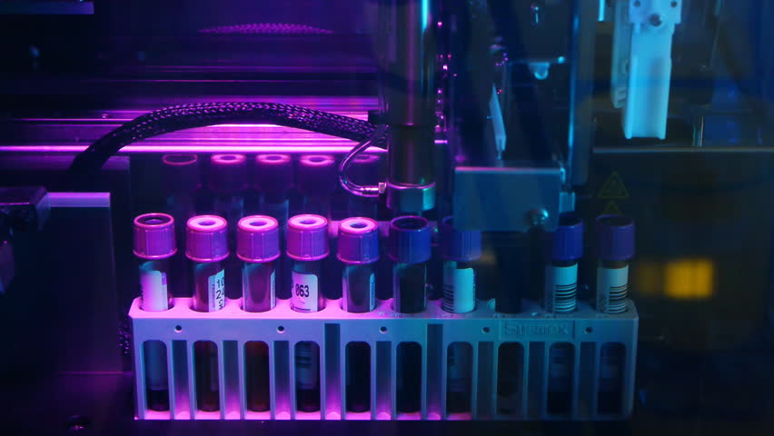 Laboratory analyzes with the help of modern medical equipment