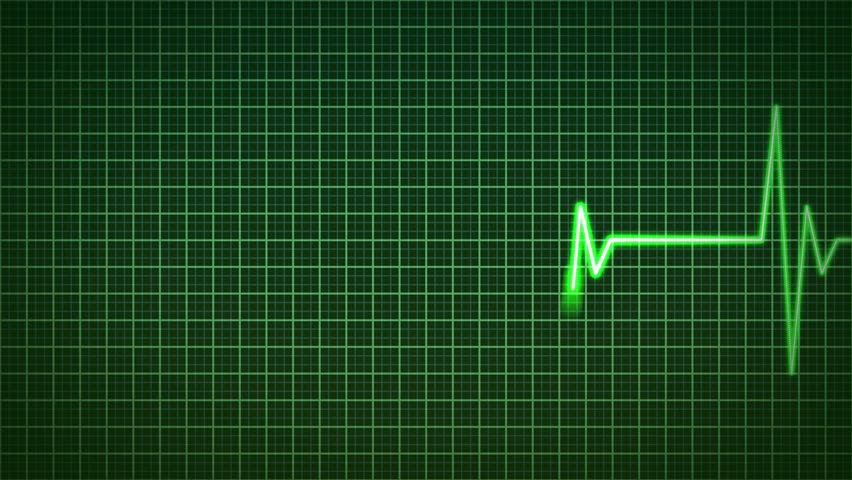 Animated cardiogram