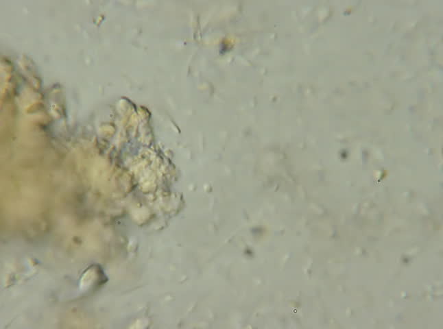 Bacteria on Infection 600x. Microscope 600x view of bacteria swimming in an infected tissue sample. 