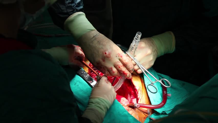 scene of an operation 17