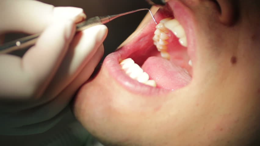 Close-up of patient open mouth during oral checkup