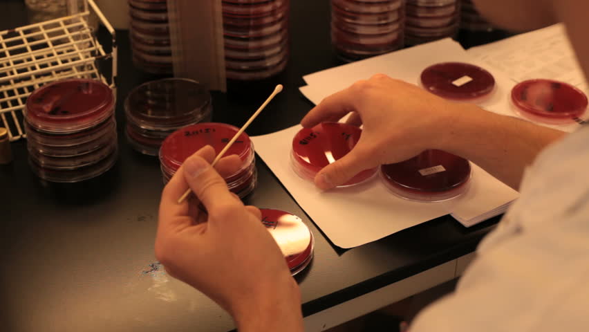 inspecting a petri dish with agar jelly on viral infections