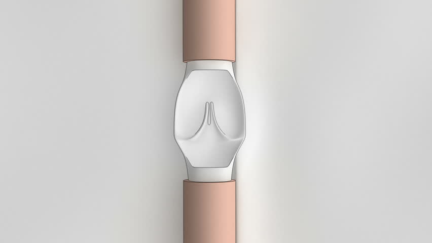 Vein valve with blood flow animation