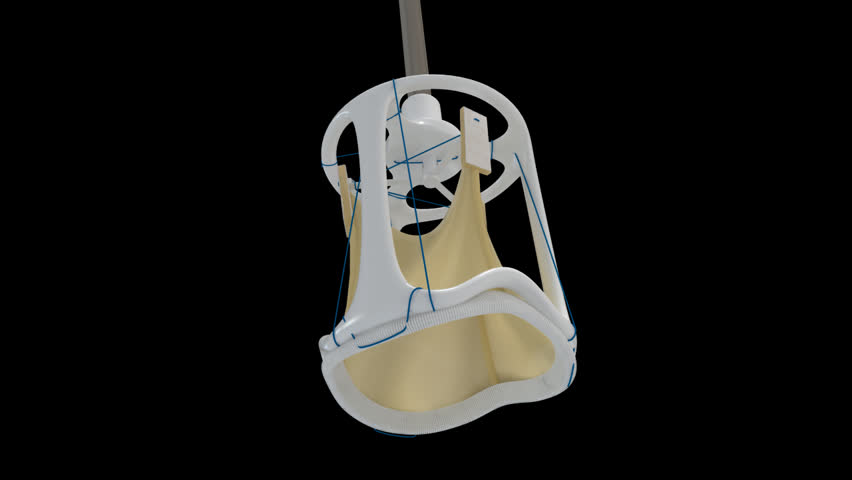 Prosthetic valve for aortic valve replacement surgery showing side detail in isolated synthetic valve