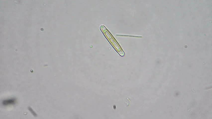 Living diatom cells under microscope, magnification 600X