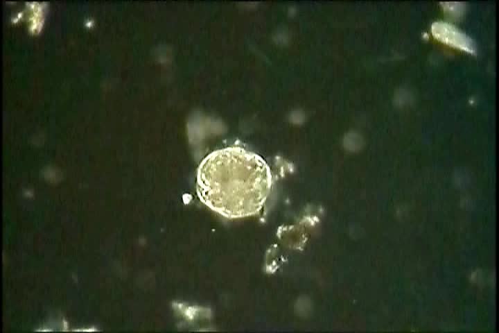 Many microscopic organisms for resistant capsules (Cysts) to survive unfavorable conditions.  Often movement can be seen inside these cysts, such as in this clip