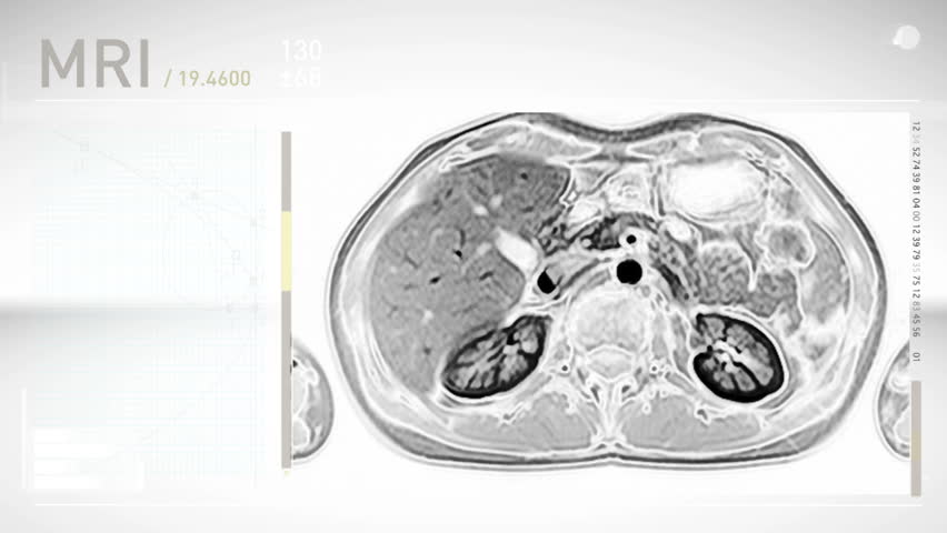 MRI Screendesign