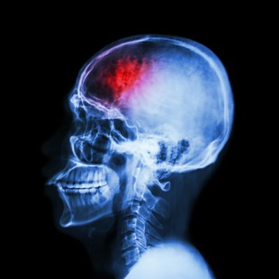 Puwadol Jaturawutthichai