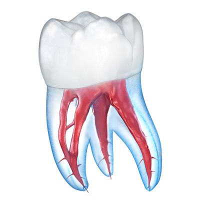 Periostitis Tooth Lump On Gum Above Stock Illustration 1710200284 ...