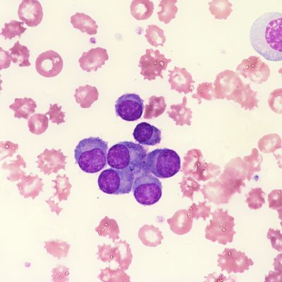 Nematodes Hookworm Rhabditiform Larva Direct Smear Stock Photo ...