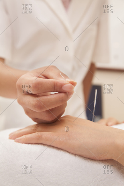 Chinese doctor using acupuncture on patient